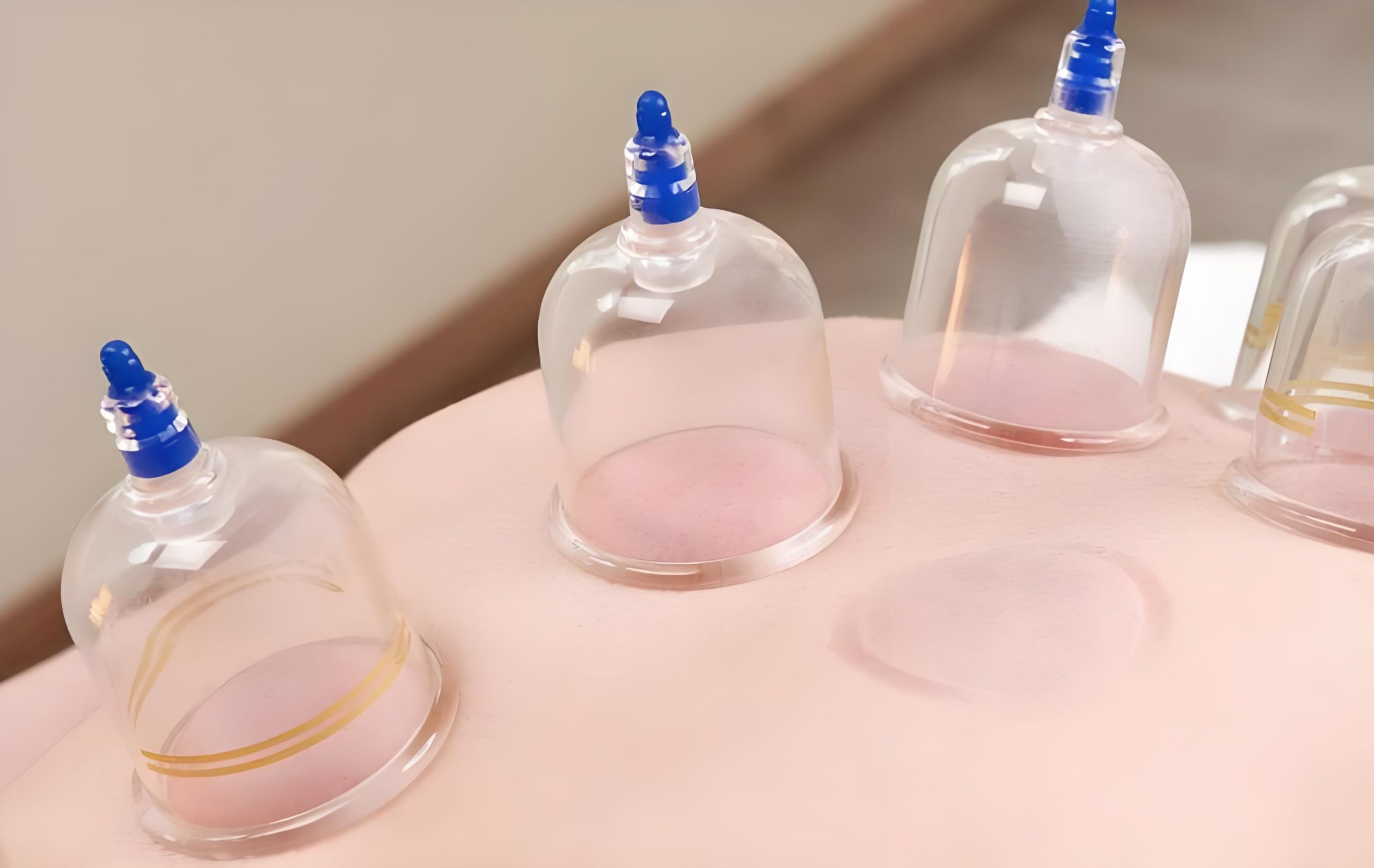 Cupping: Why Those Round Marks Are Actually a Good Sign
