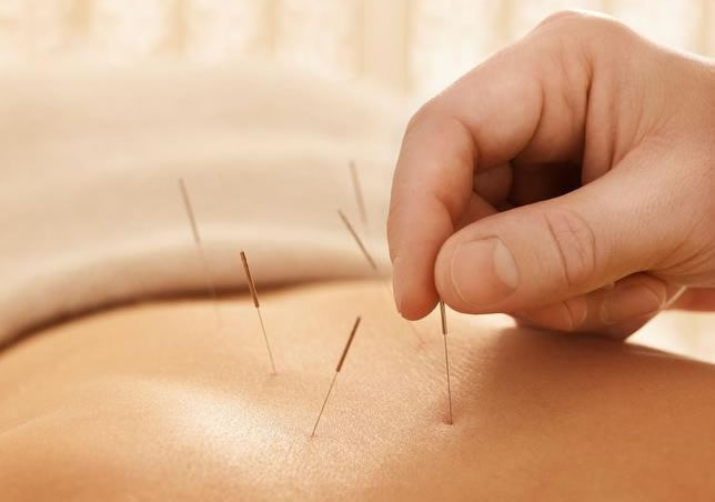 Acupuncture: More Than Just Needles